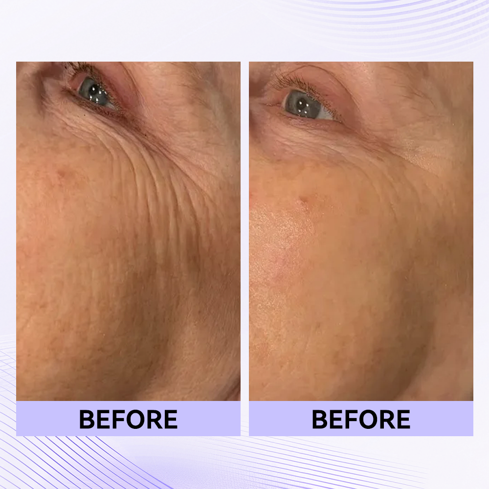 Last 3 Hours:š„ Up to 15% OFF ā Instant Eye Tightener Easy-Wear Formula